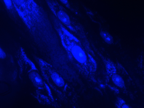 Mycoplasma Mycoplasma