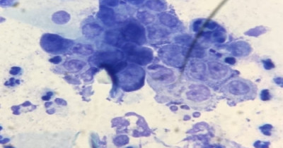 Chlamydia Chlamydia