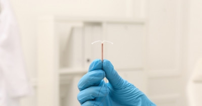 intrauterine birth control device intrauterine birth control device