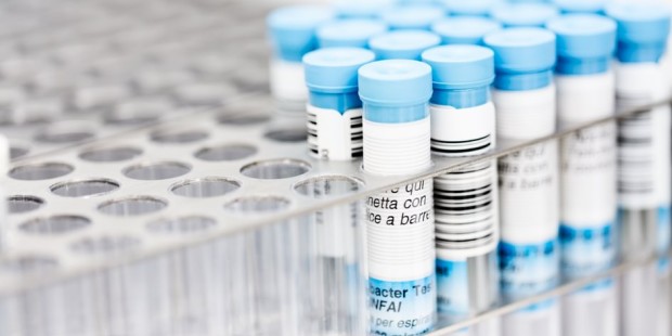 A bunch of tests held up in vials.